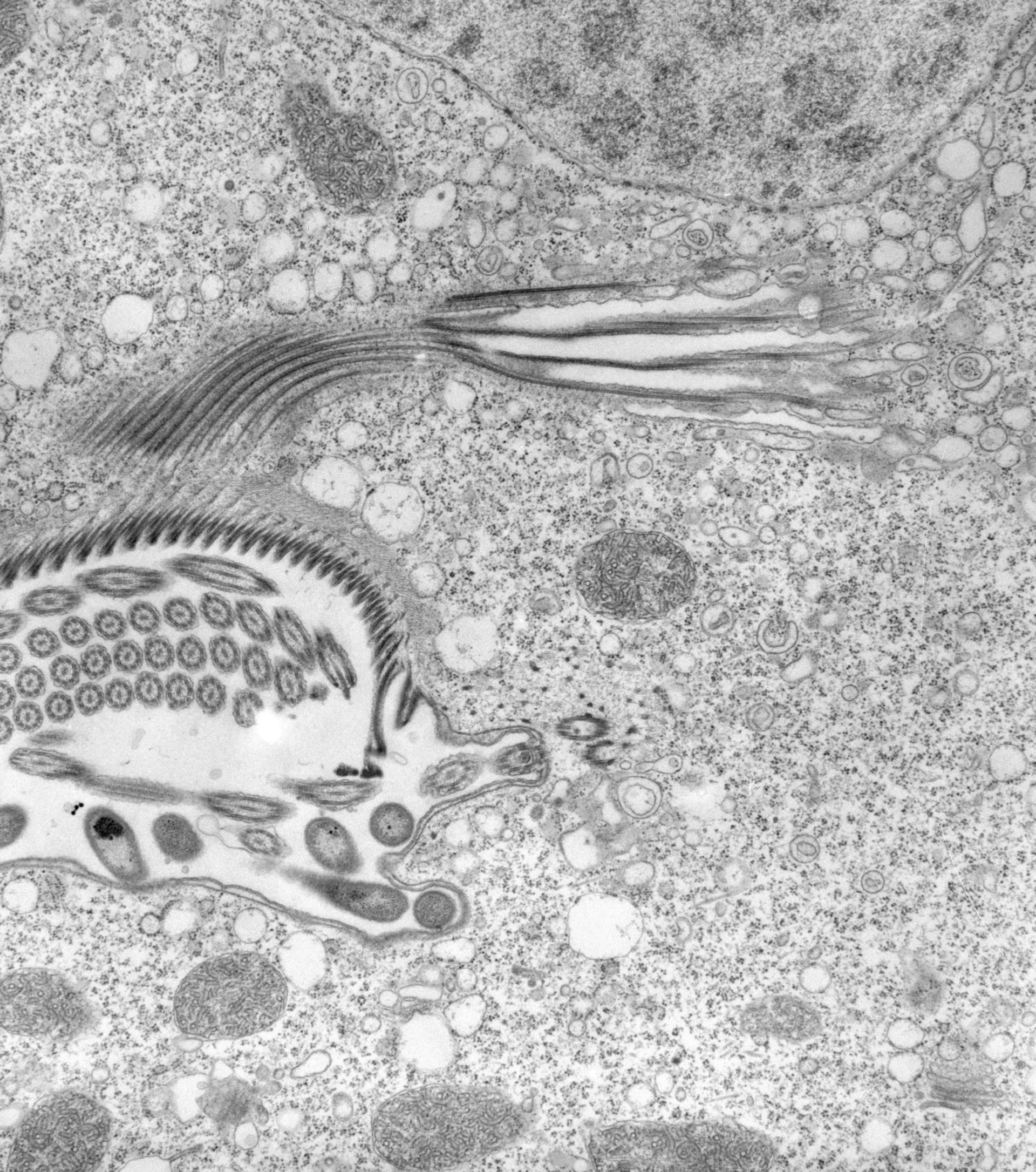 Vorticella convallaria (Cortical microtubule cytoskeleton) - CIL:39463