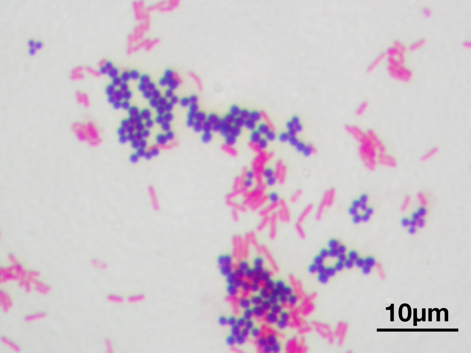 gram_stain_01_original.jpg