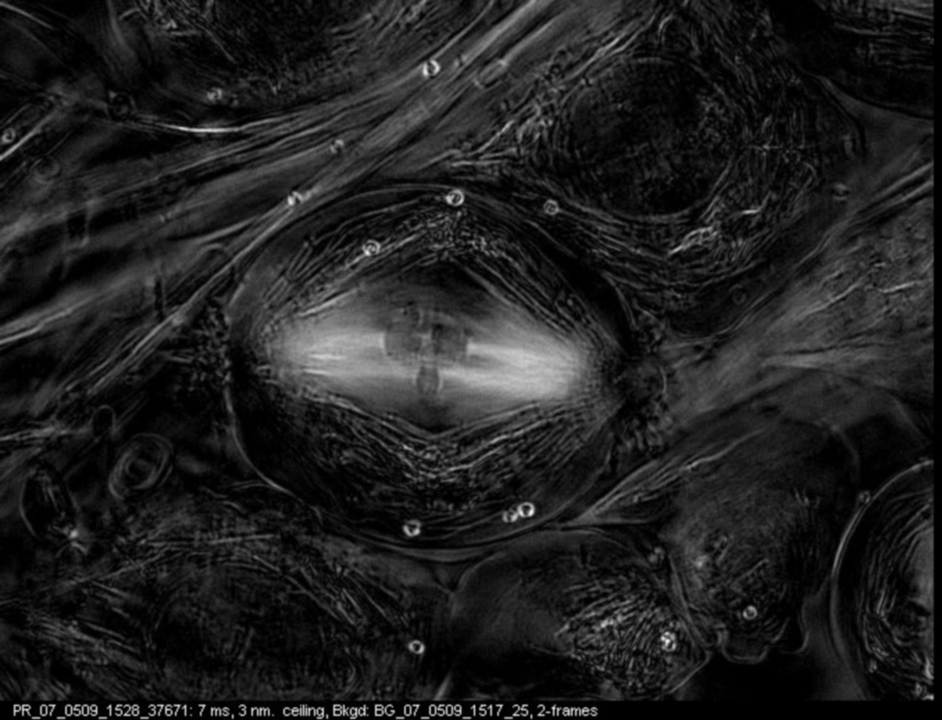 Nephrotoma suturalis (Cytoskeleton) - CIL:9062