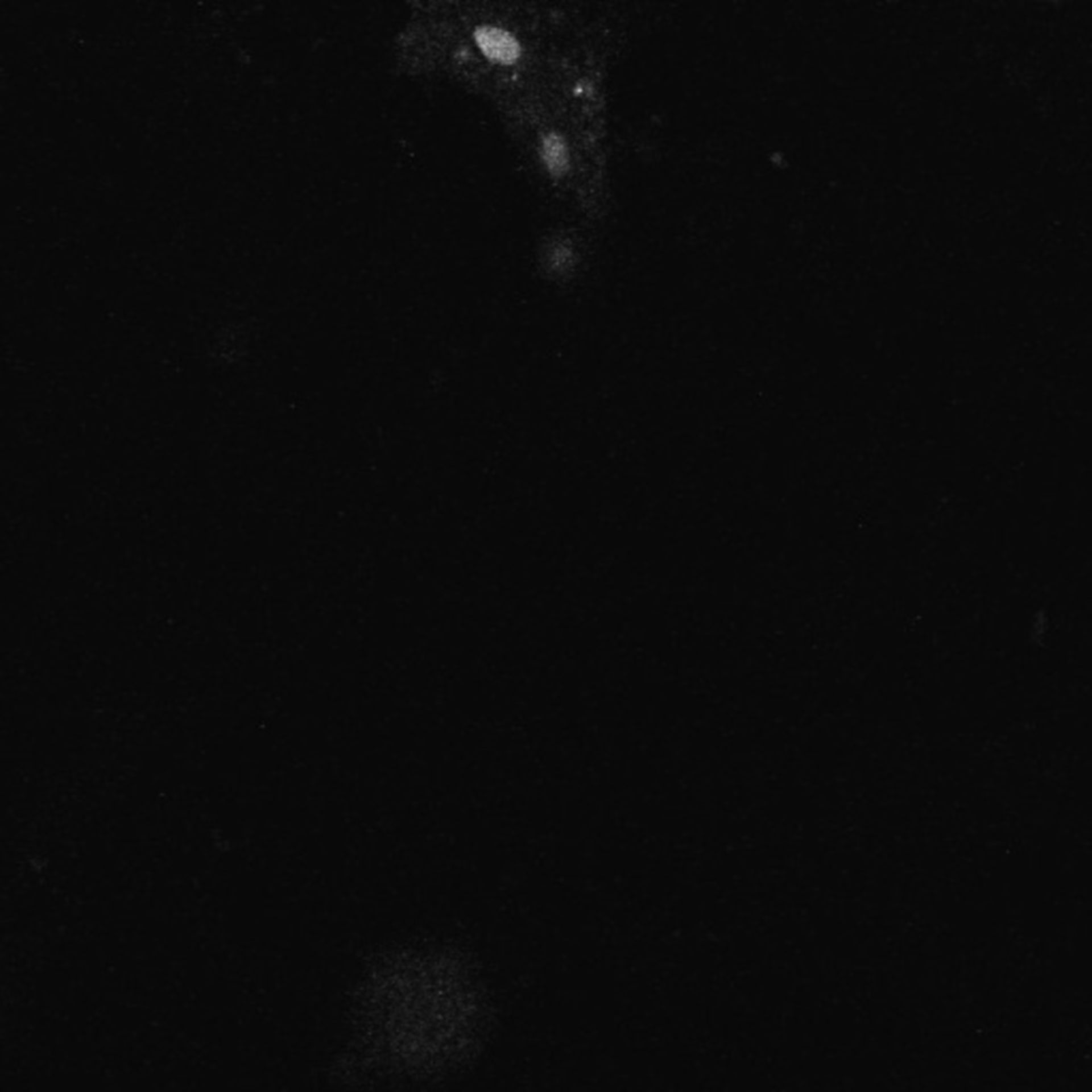 Xenopus laevis (Axon) - CIL:37021