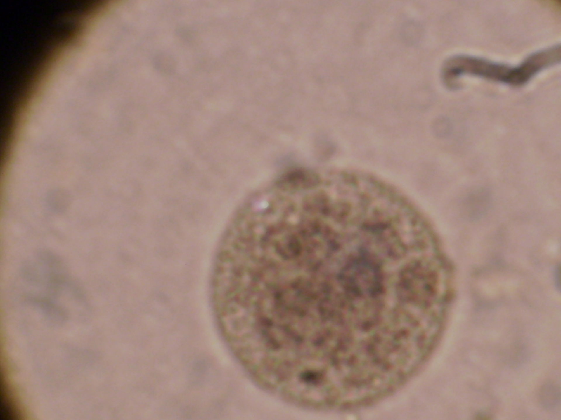 Entamoeba coli в кале. Цисты Entamoeba. Entamoeba coli циста. Циста лямблии под микроскопом. Цисты лямблии микроскопия.