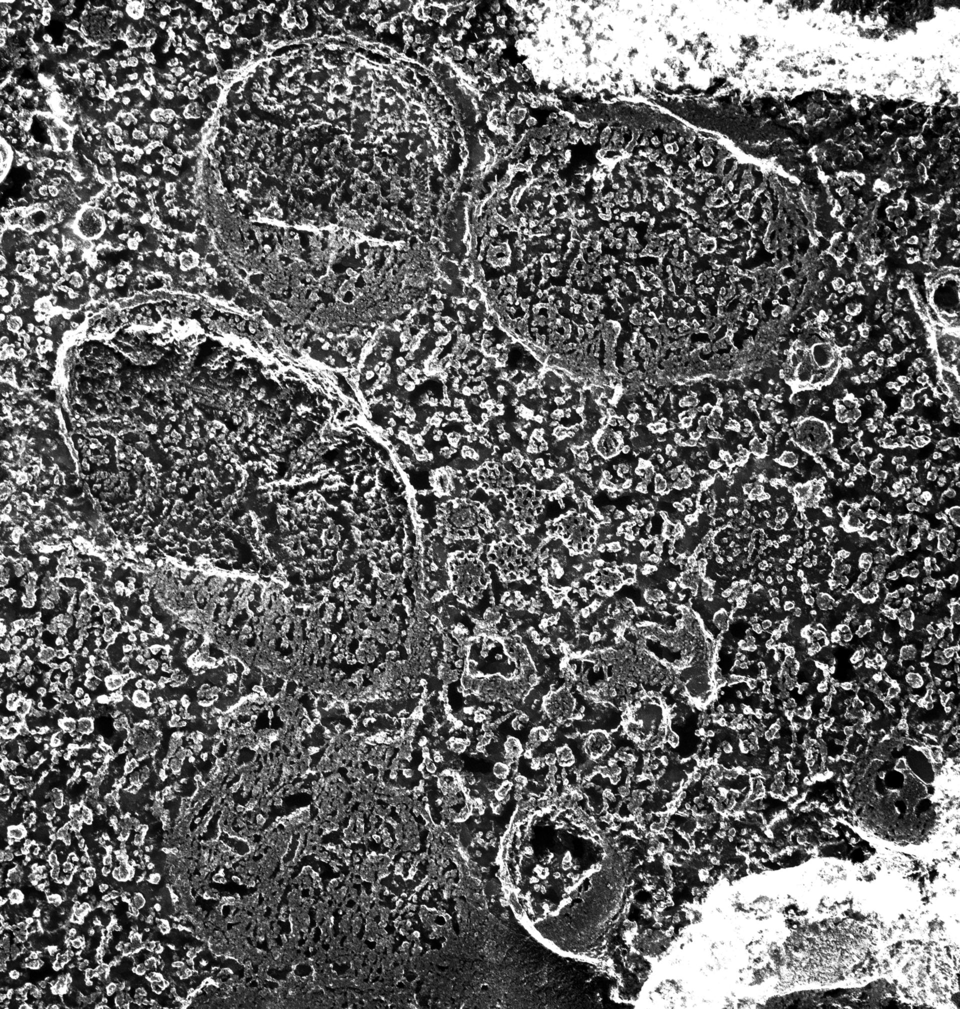 Paramecium multimicronucleatum (Clathrin coat) - CIL:12640