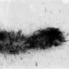 Residual DocCheck Flexikon