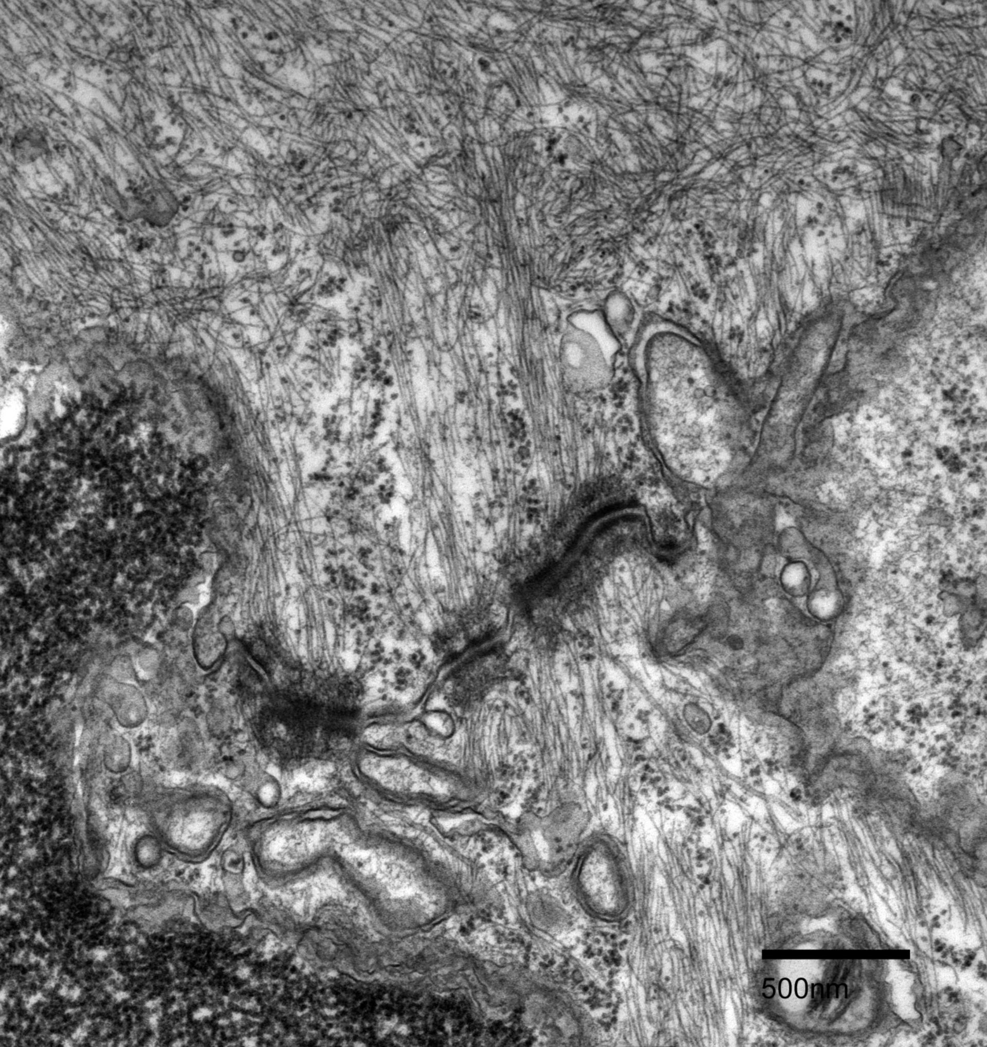 Fundulus heteroclitus (Microtubule) - CIL:27225