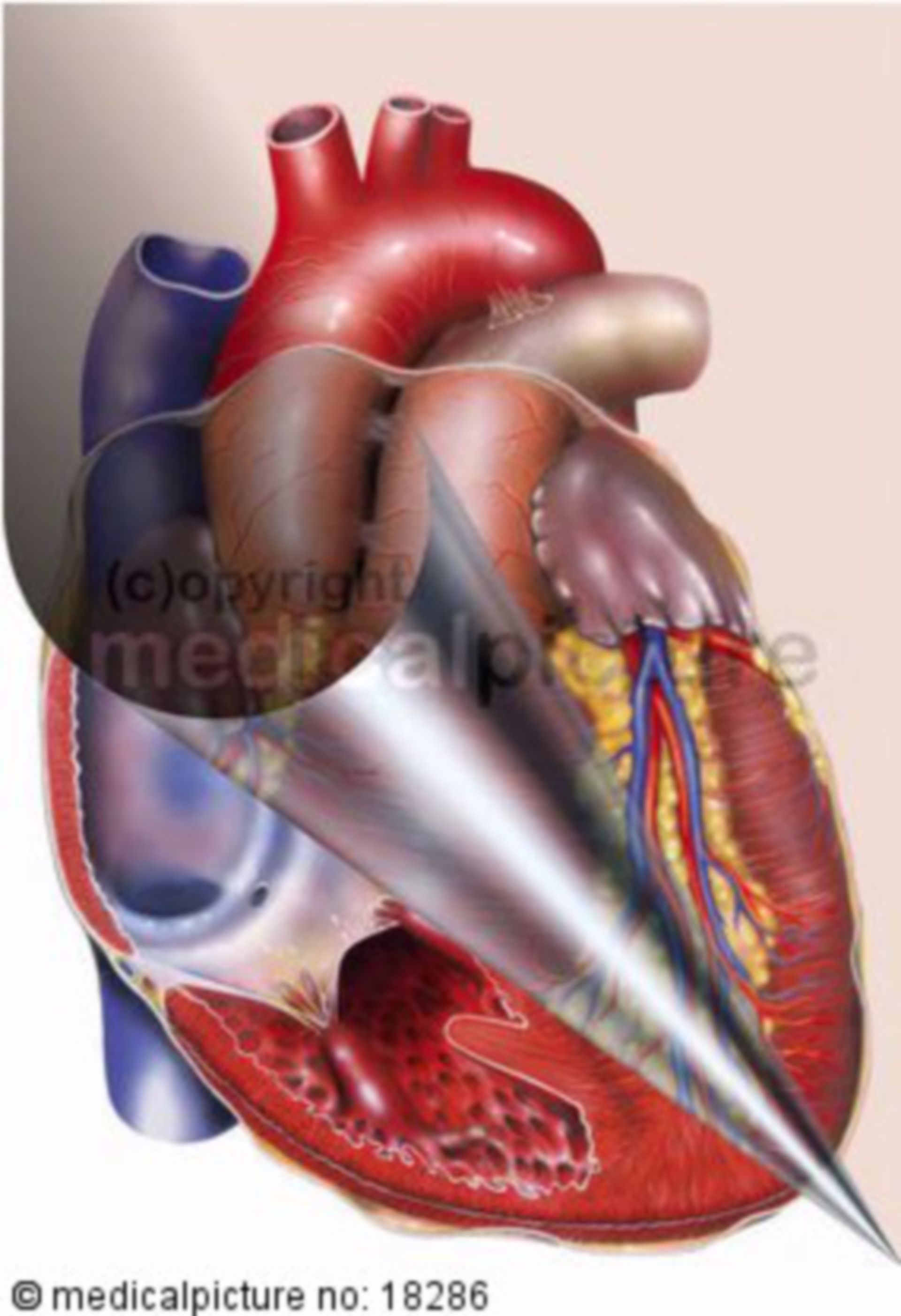 Right ventricle