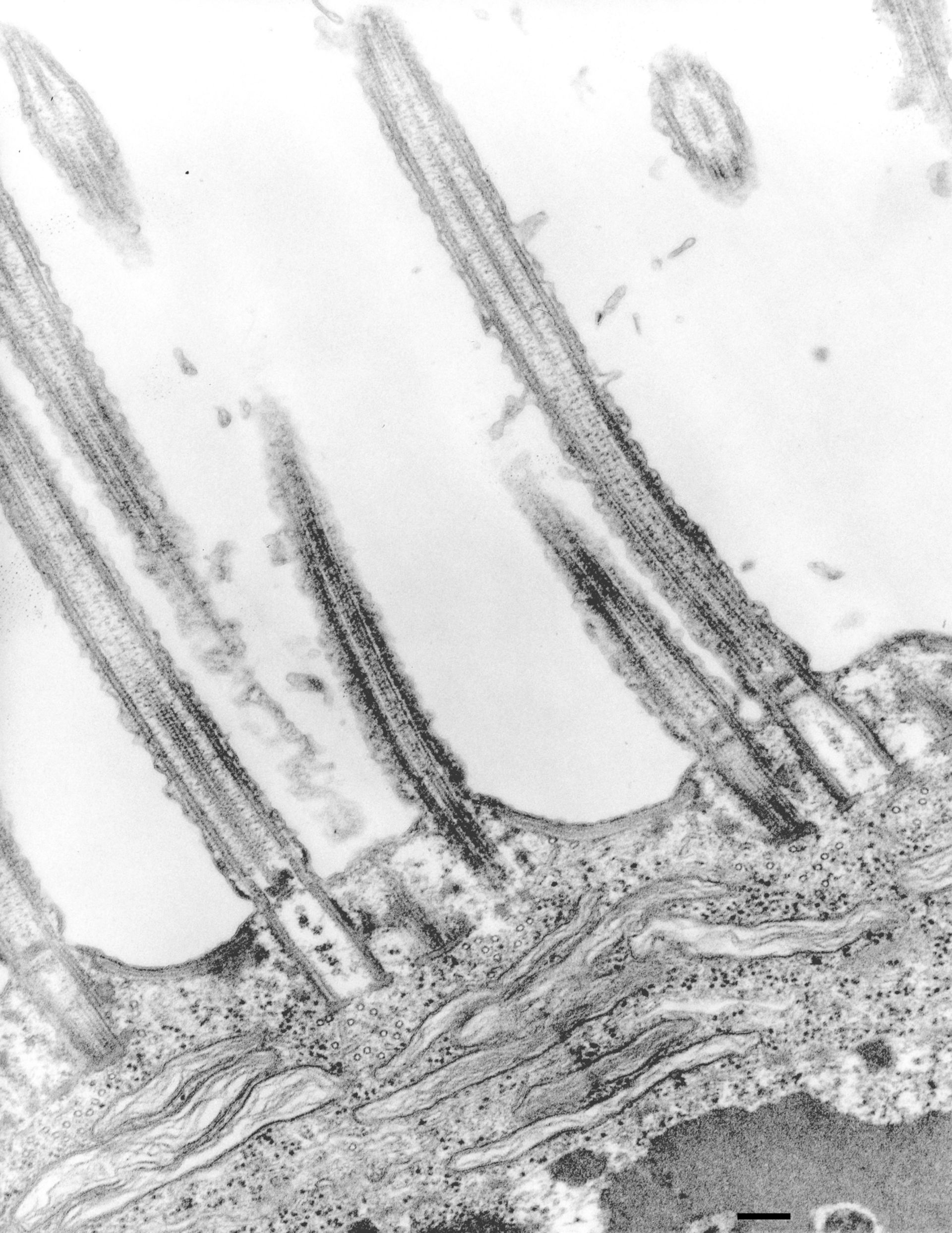 Euplotes sp. (Microtubule basal body) - CIL:12342