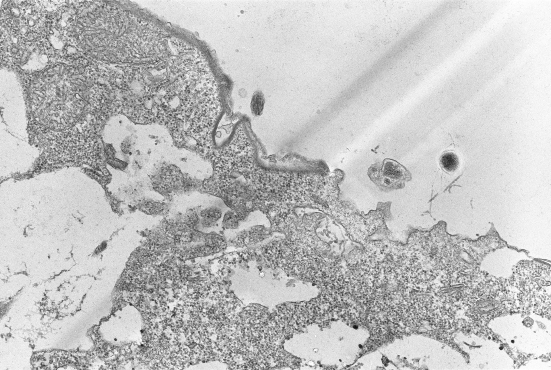 Colpoda cucullus (Cytoproct) - CIL:2858