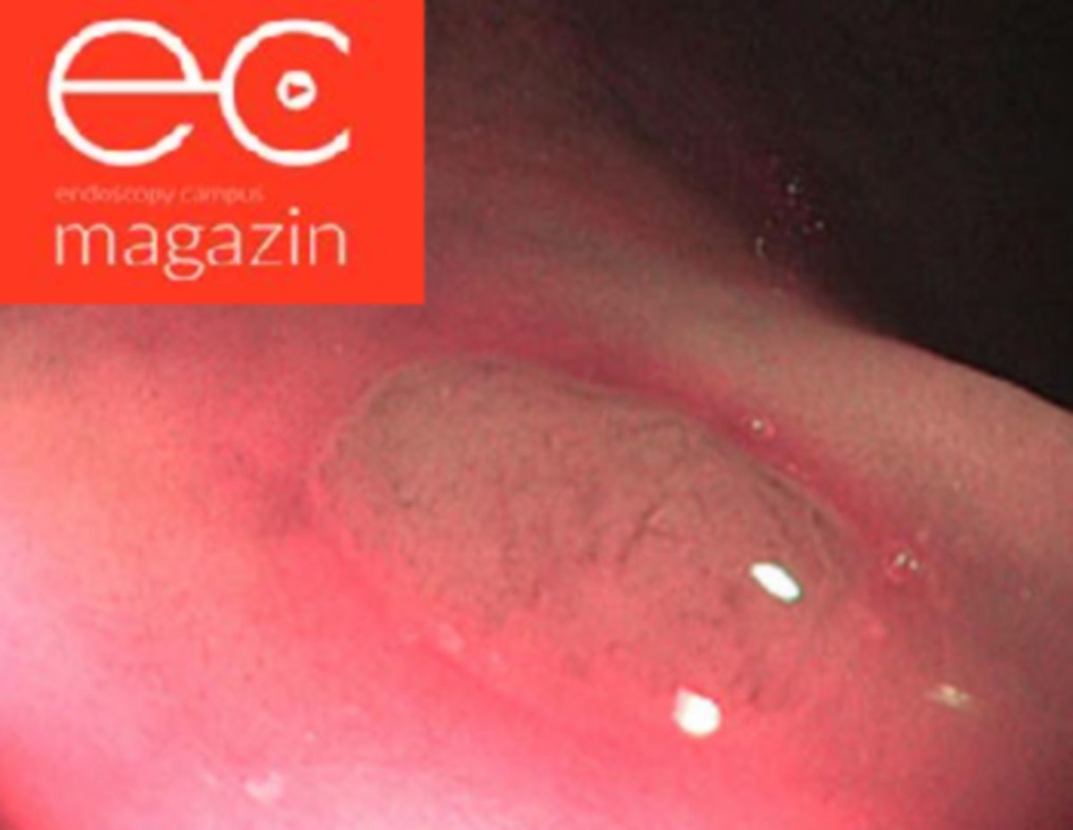 Blood -F様 Frontiers | Blood-based biomarkers in pancreatic ductal