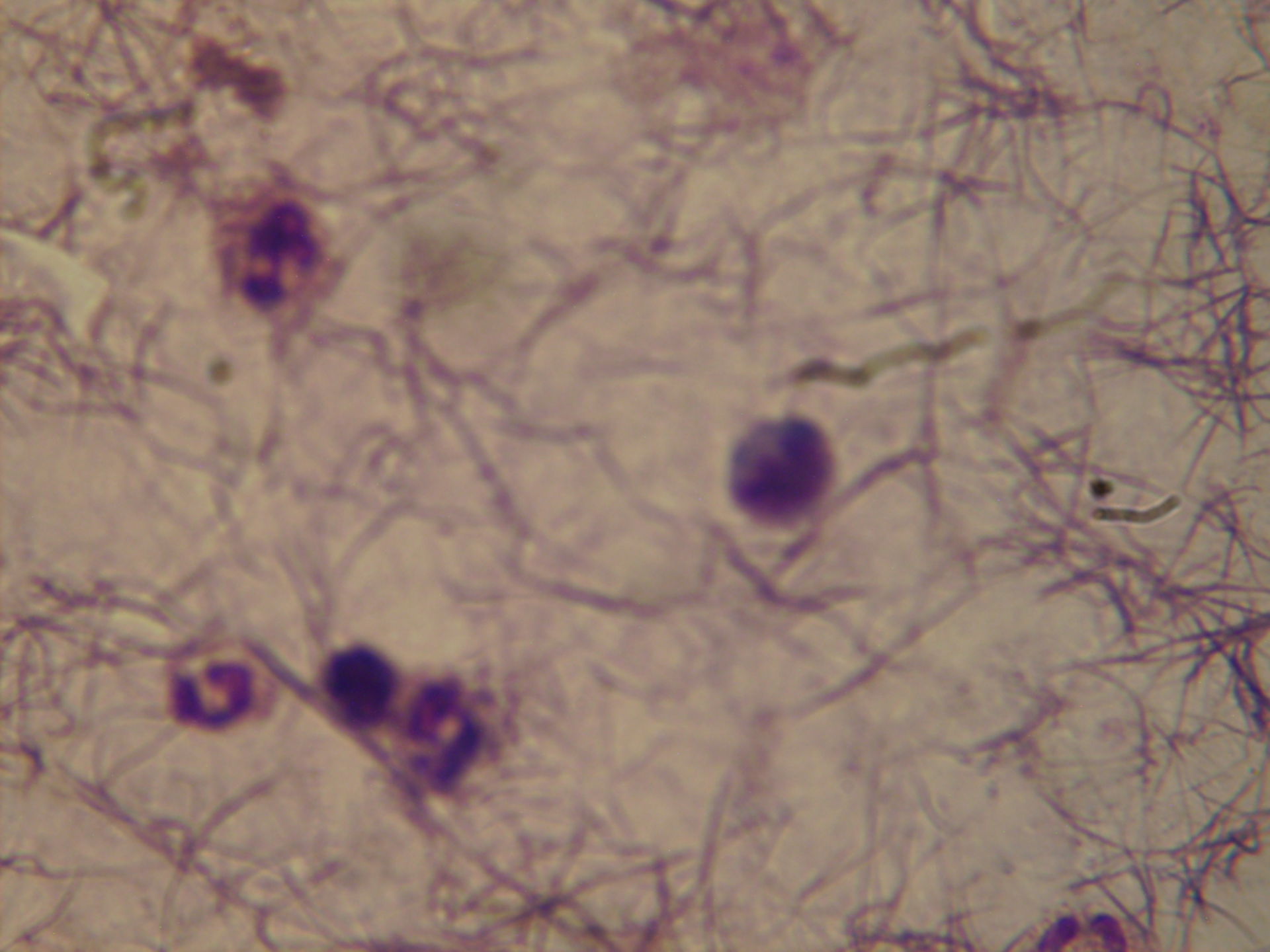 plasmodium ovale schüffner typfungd