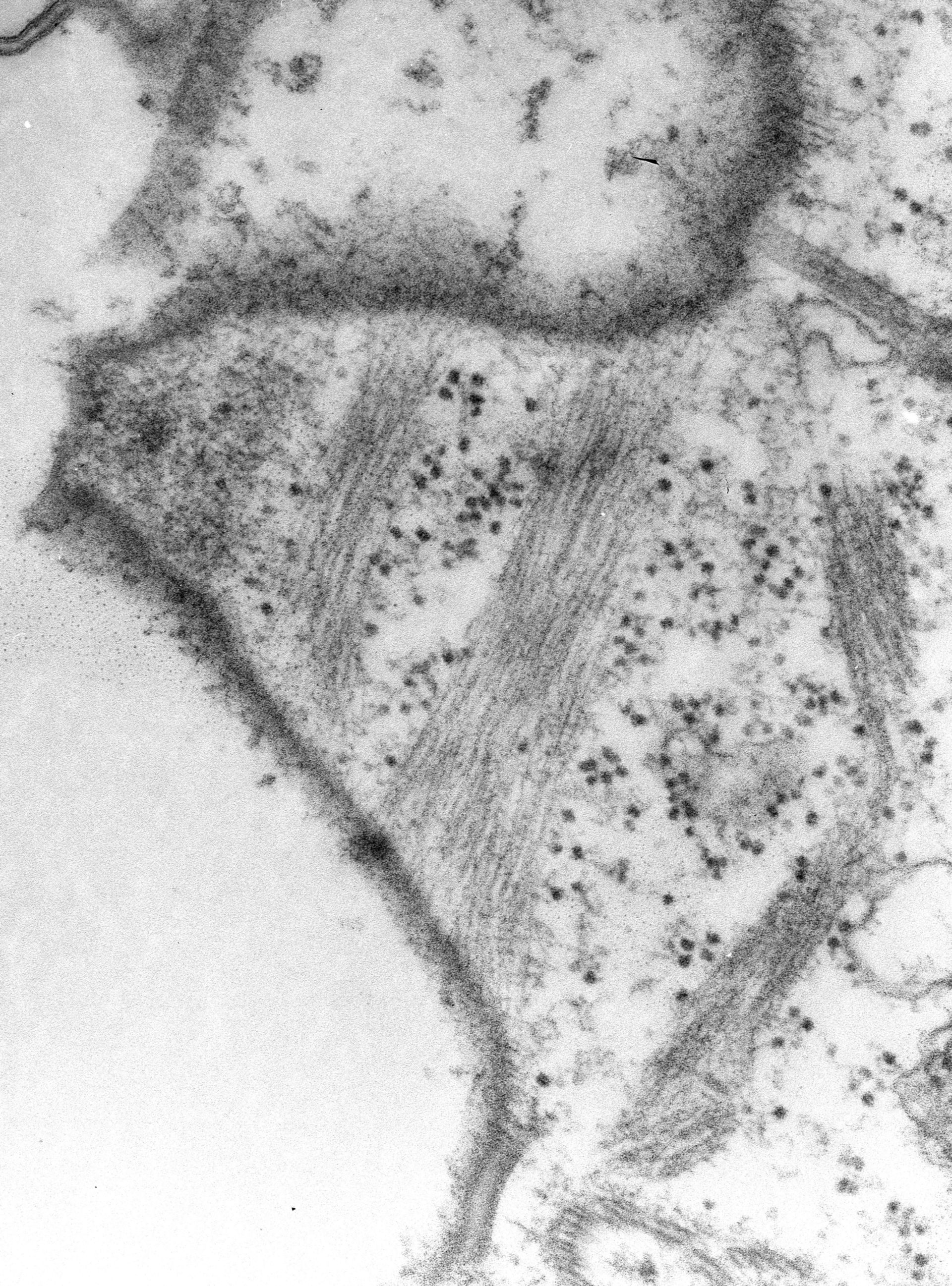 Paramecium multimicronucleatum (Cell cortex) - CIL:39307