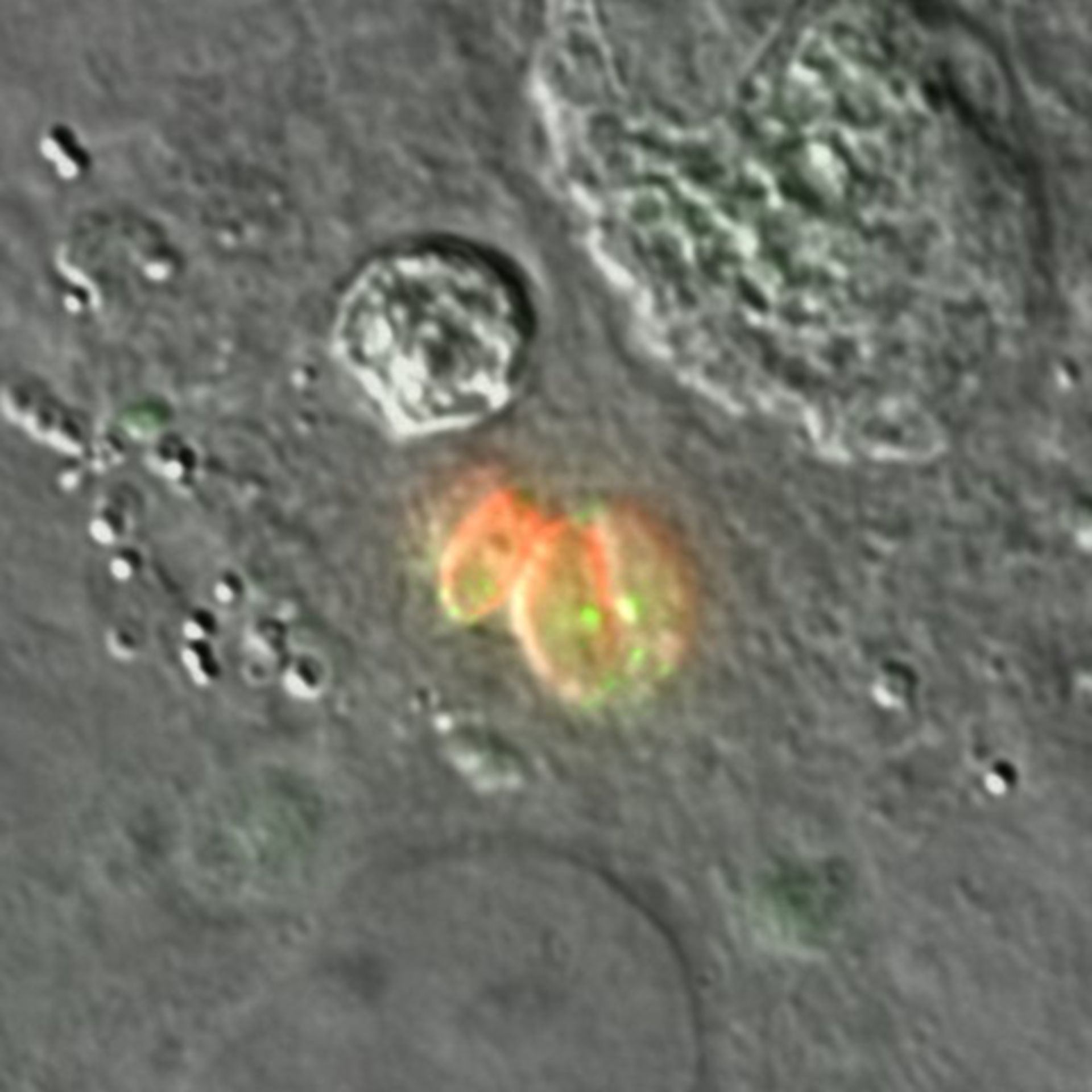 Toxoplasma gondii RH (Polar ring of apical complex) - CIL:10511