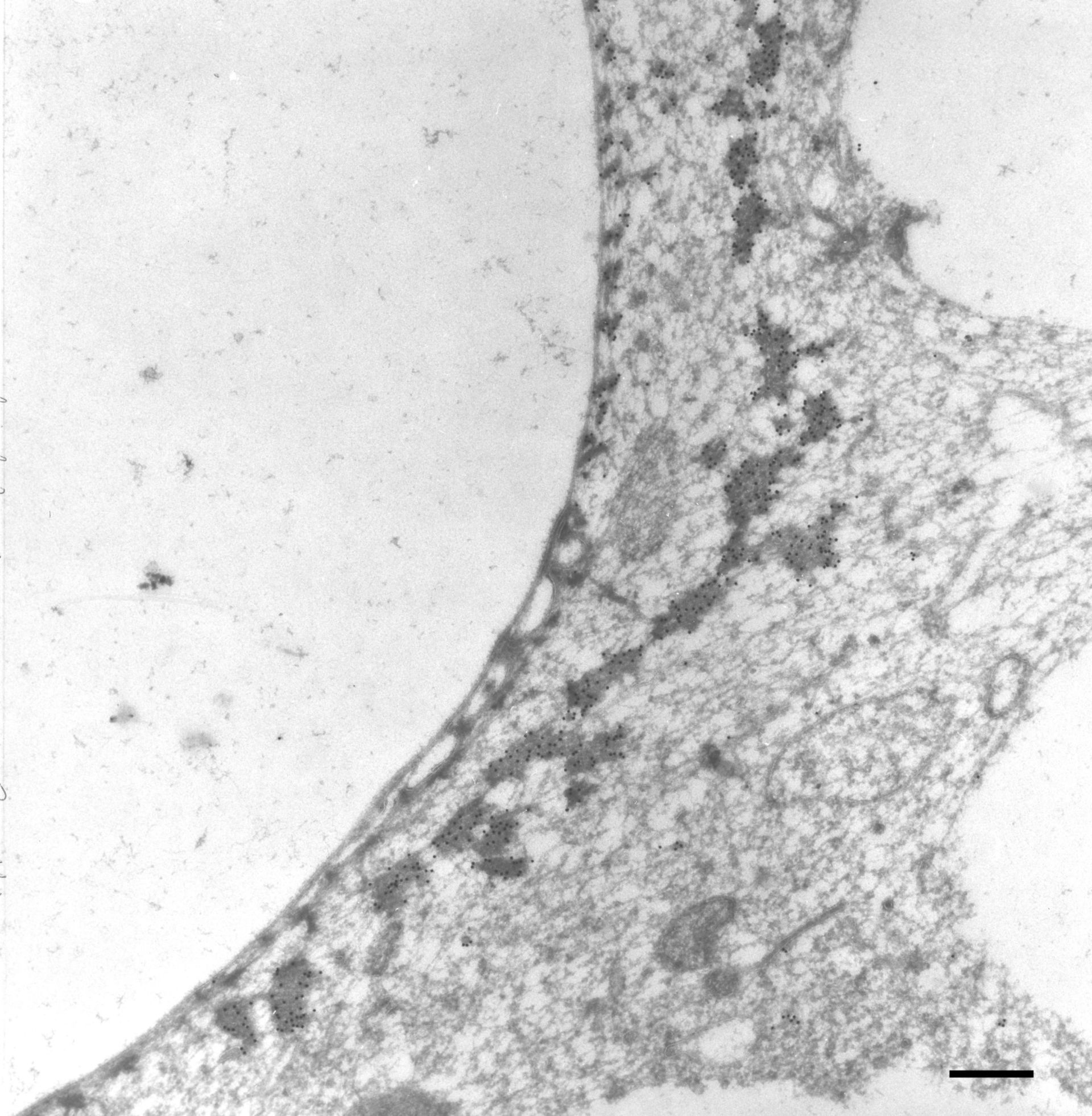 Paramecium multimicronucleatum (Cortical microtubule cytoskeleton) - CIL:36713
