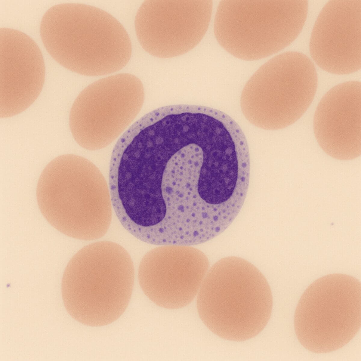 Stabkerniger Granulozyt