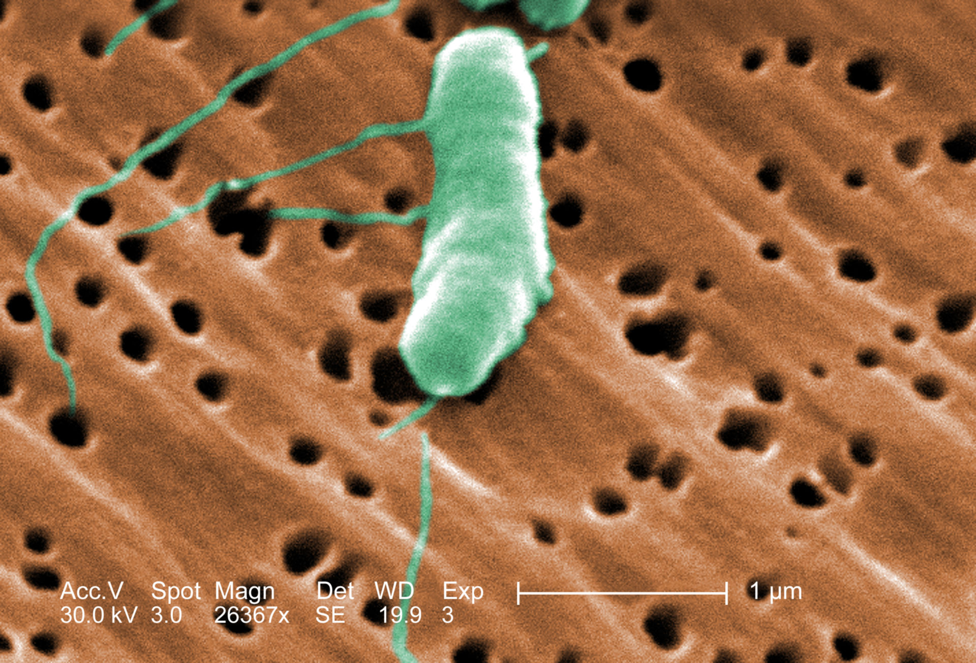 Vibrio vulnificus (SEM)