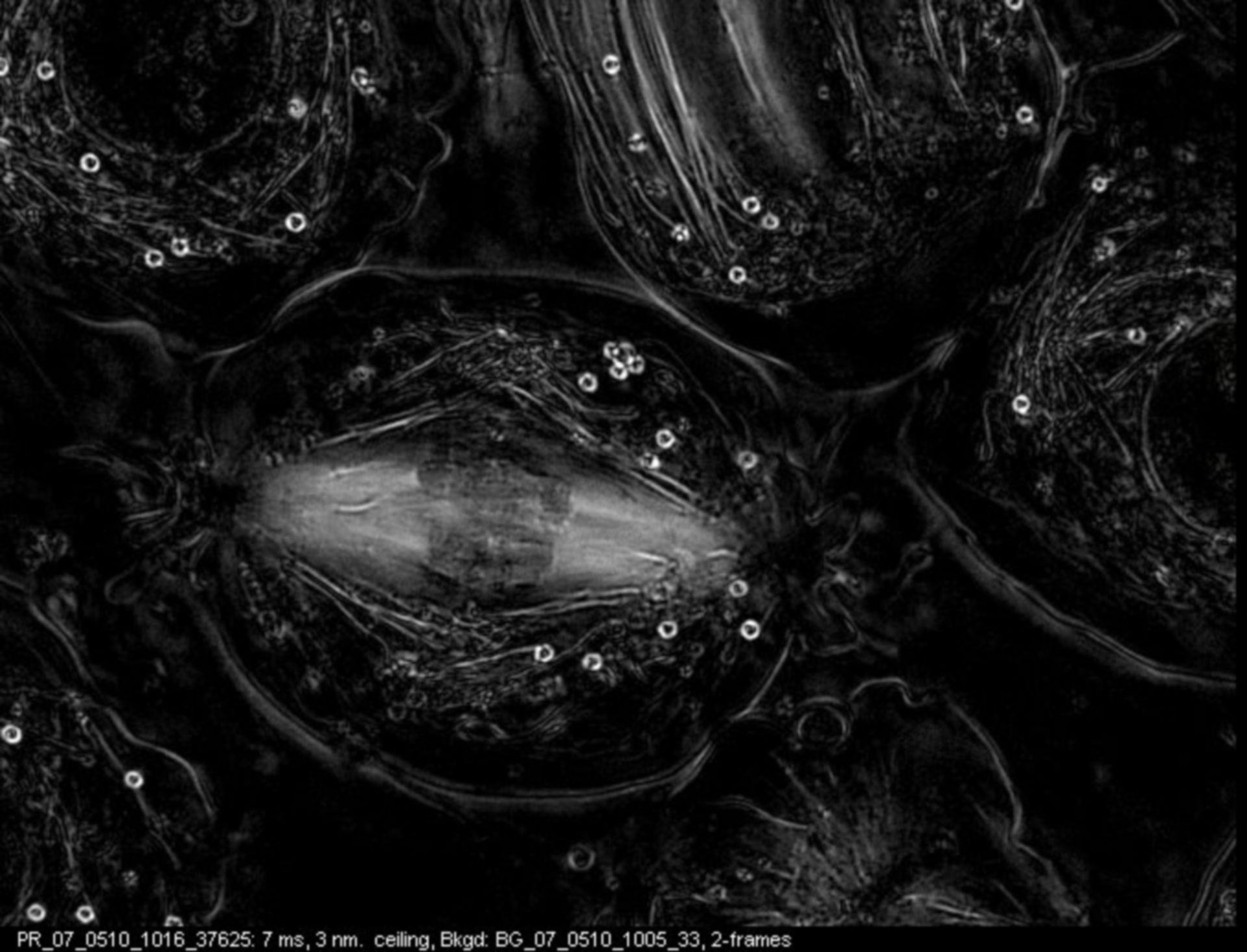 Nephrotoma suturalis (Cytoskeleton) - CIL:9064