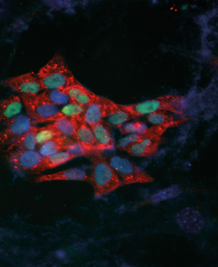 Humane pluripotente Stammzellkolonie angereichert mit LINE-1 Proteinen (rot), die zur Mobilisierung springender Gene im Stammzellgenom führen. Zellkerne sind blaugrün angefärbt. © Klawitter S et al.: Nature Communications