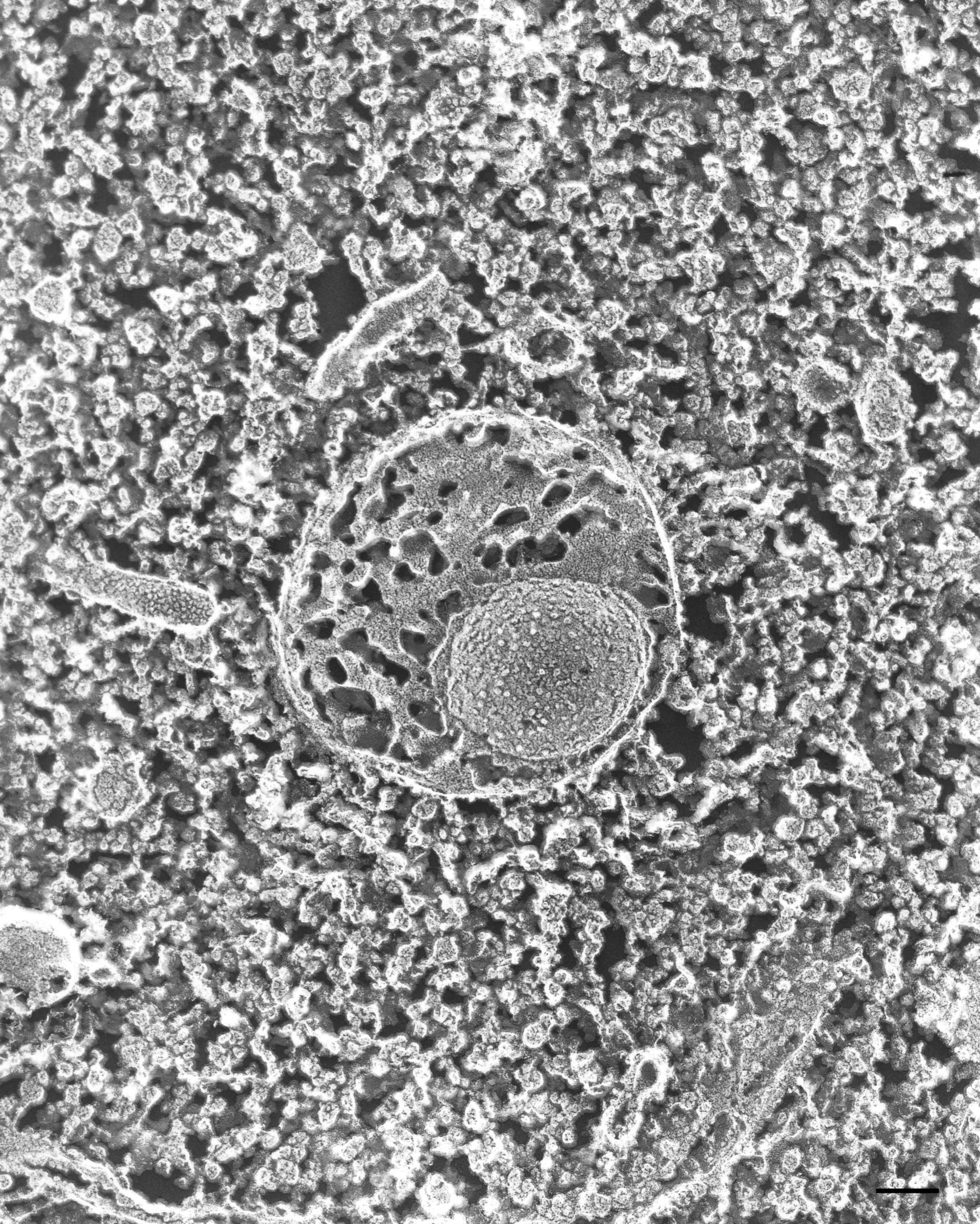 Paramecium multimicronucleatum (Vesicle lumen) - CIL:36730