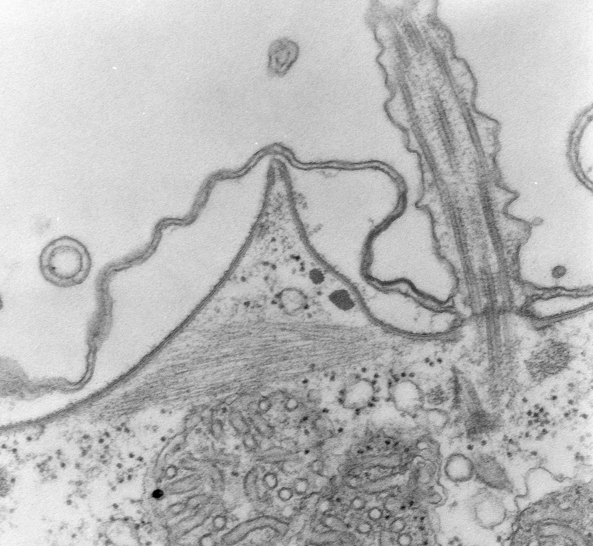 Paramecium multimicronucleatum (Cell cortex) - CIL:39308
