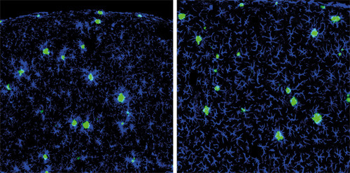 Links: hirneigene Mikroglia (blau) um Alzheimer Aβ-Plaques (grün) im Gehirn einer Alzheimer Maus. Rechts: aus der Peripherie in das Gehirn eingewanderte „neue“ Makrophagen, die sich rasch im Gehirn verteilen und zu Mikroglia-ähnlichen Zellen umwandeln, aber Aβ-Plaques ignorieren. © The Journal of Experimental Medicine