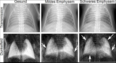 In der Maus zeigt sich ein deutlicher Signalabfall im Dunkelfeld-Röntgenbild (untere Zeile) der vom Emphysem betroffenen Lunge. Im konventionellen Bild (obere Zeile) ist die Krankheit selbst für den Experten nicht zuverlässig erkennbar. © Klinikum der Universität München