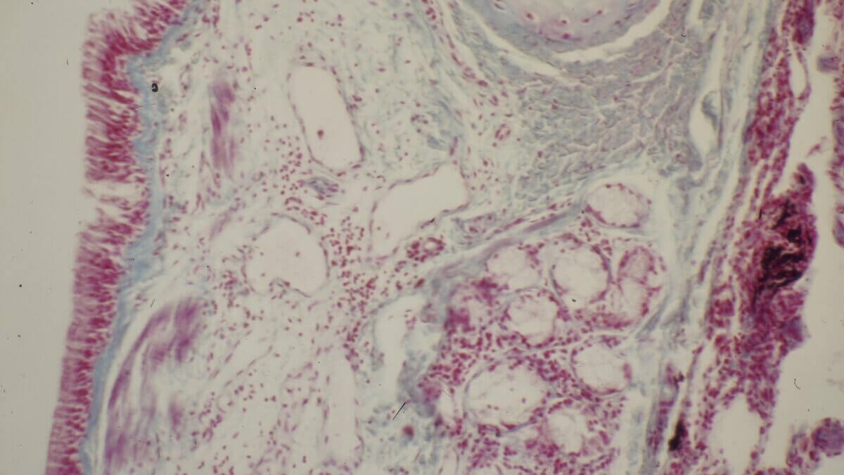Bronchus (Histologie)