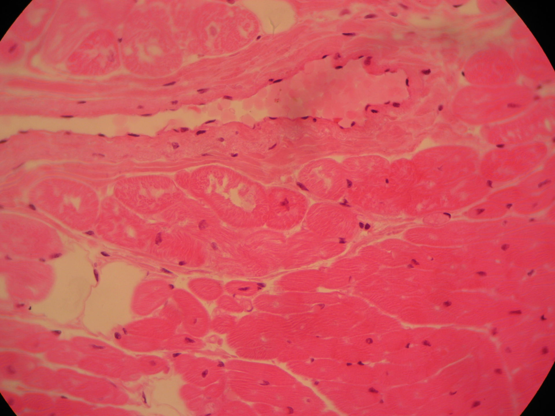 Heart muscle, purkinje cell,sheep