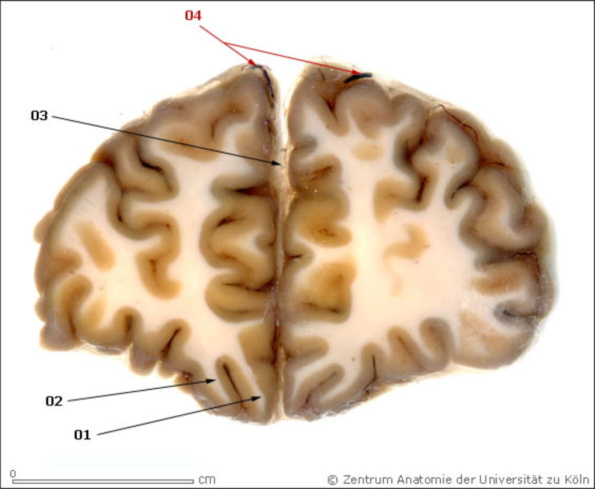 Gehirn - 3. Aufnahme Hirnschnitte (rostral beginnend)