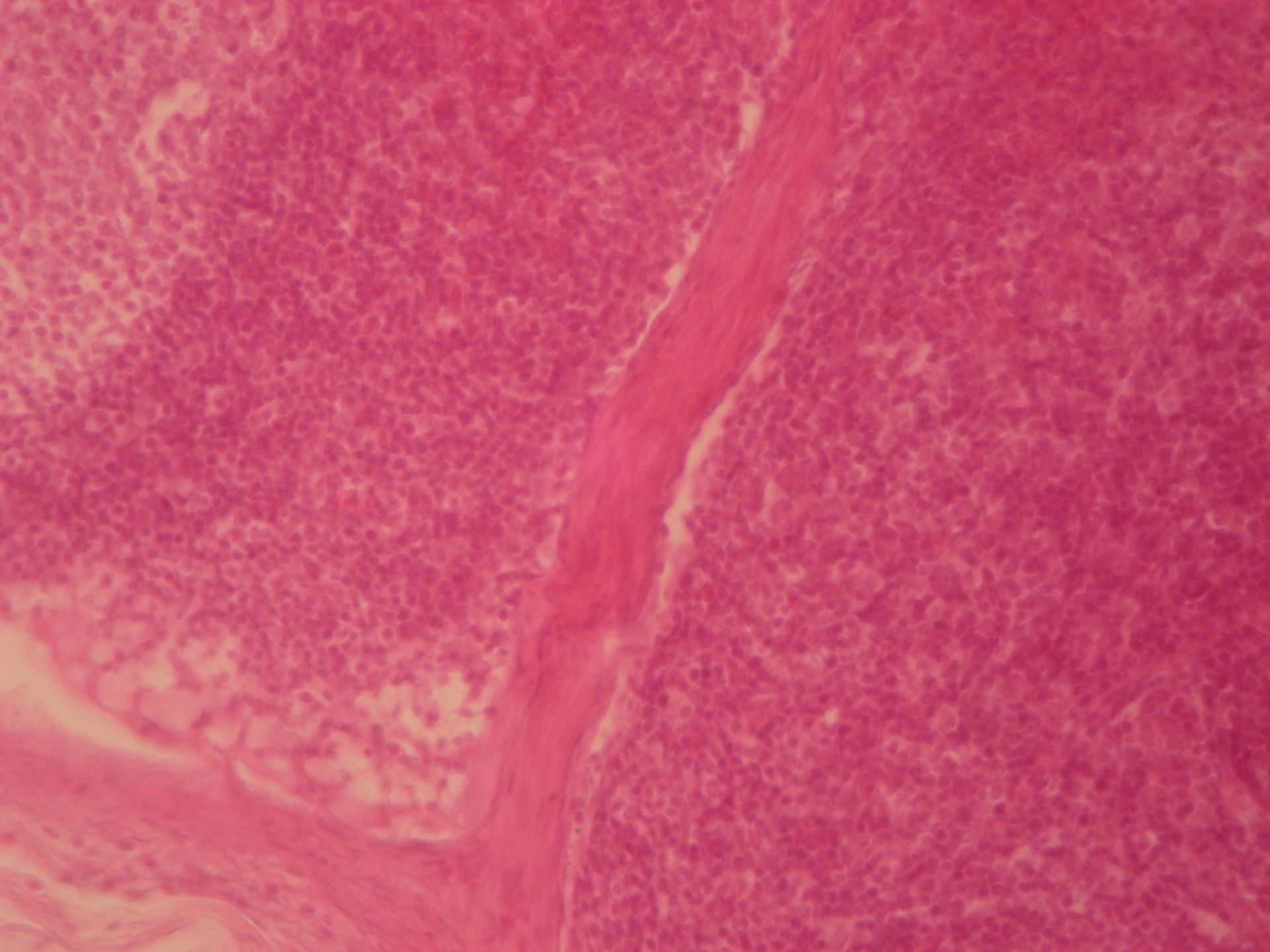 Lymphknoten des Rindes 3 - Trabekel und Intermediärsinus
