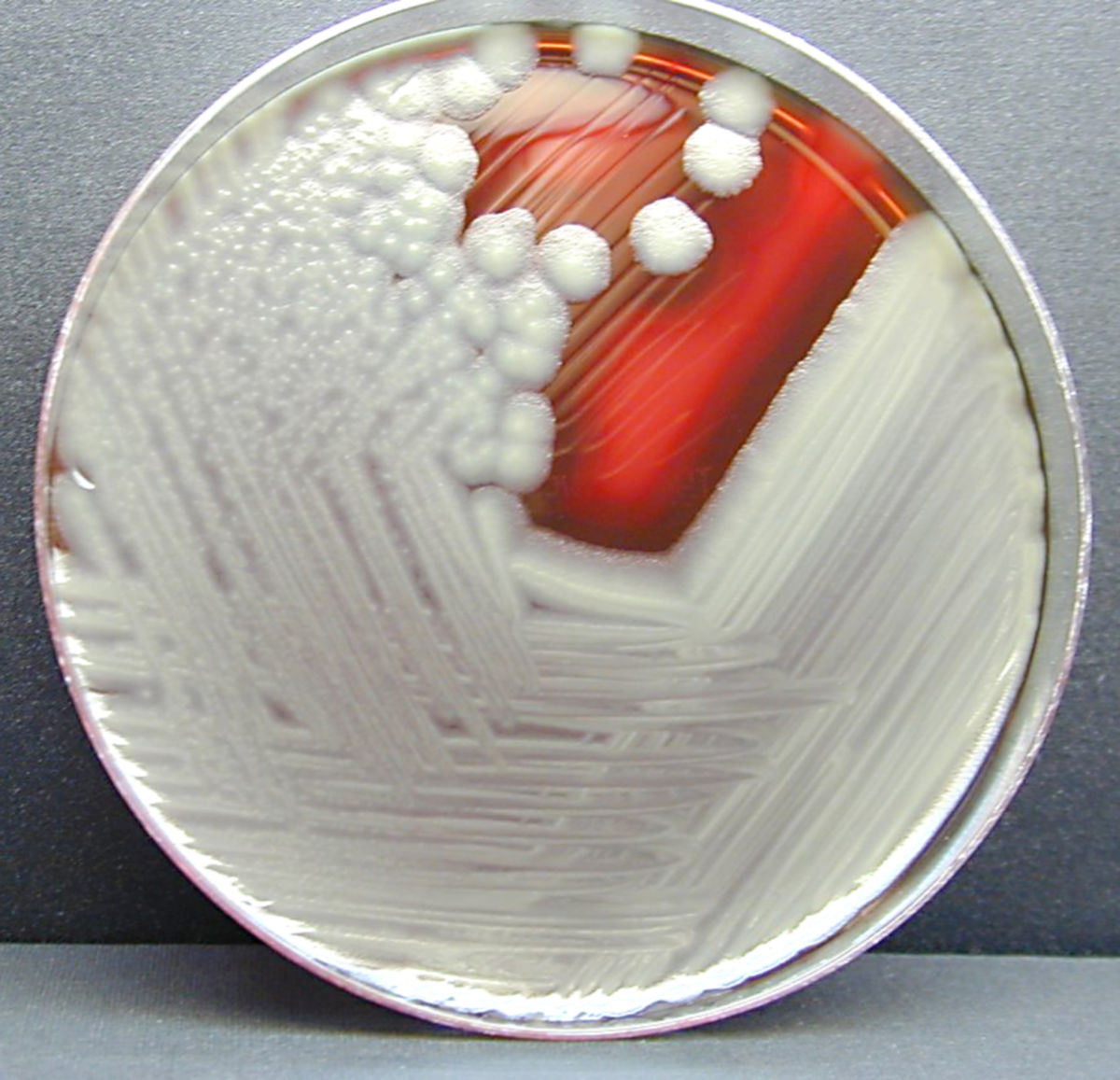 Bacillus cereus (SBA-Kultur, Hämolyse)