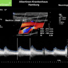 Duplex - DocCheck Flexikon