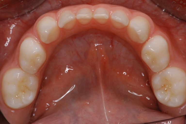 Mandibula - DocCheck Flexikon