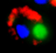 Anhäufungen von PolyQ-Proteinen (rot) verhindern den Abbau von fehlgefalteten Proteinen (grün) und sammeln sich in Einschlüssen im Zellinneren an. Der Zellkern ist in blau angefärbt. © Bild: Sae-Hun Park, Copyright: MPI für Biochemie. 