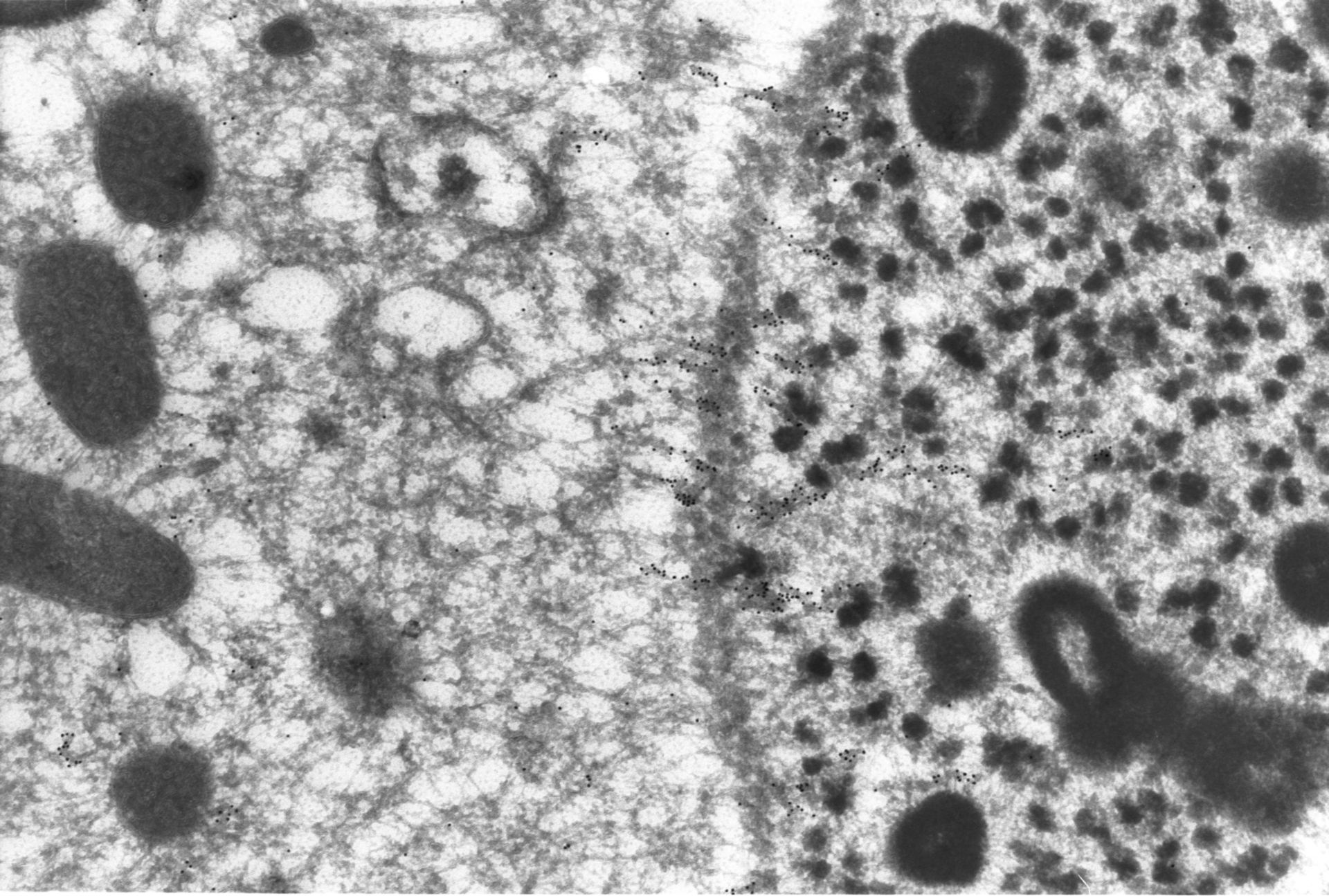 Paramecium tetraurelia (microtubuli nucleari) - CIL:1313