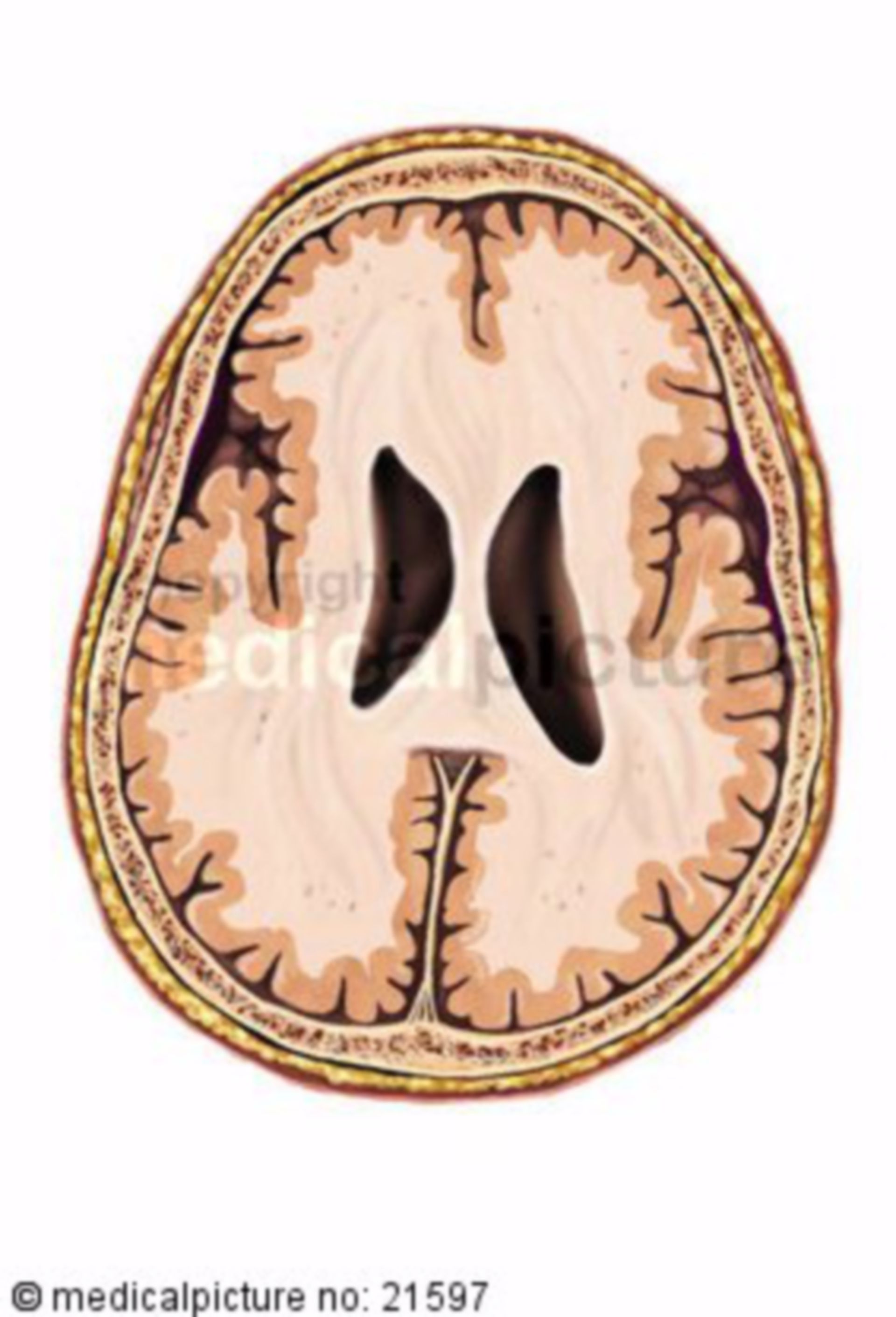 Horizontalschnitt des Gehirns auf Höhe der Basalganglien 
