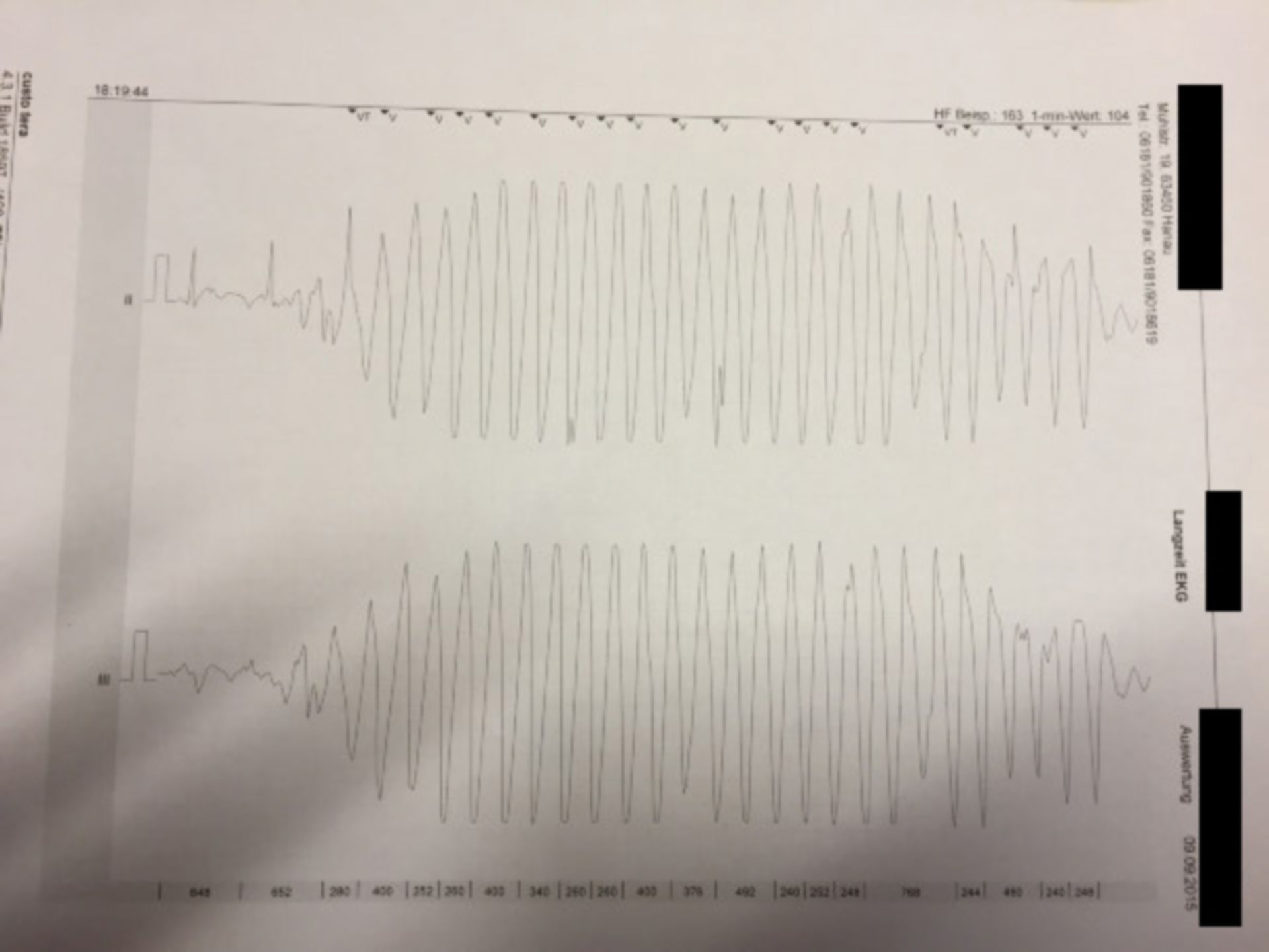 Langzeit-EKG