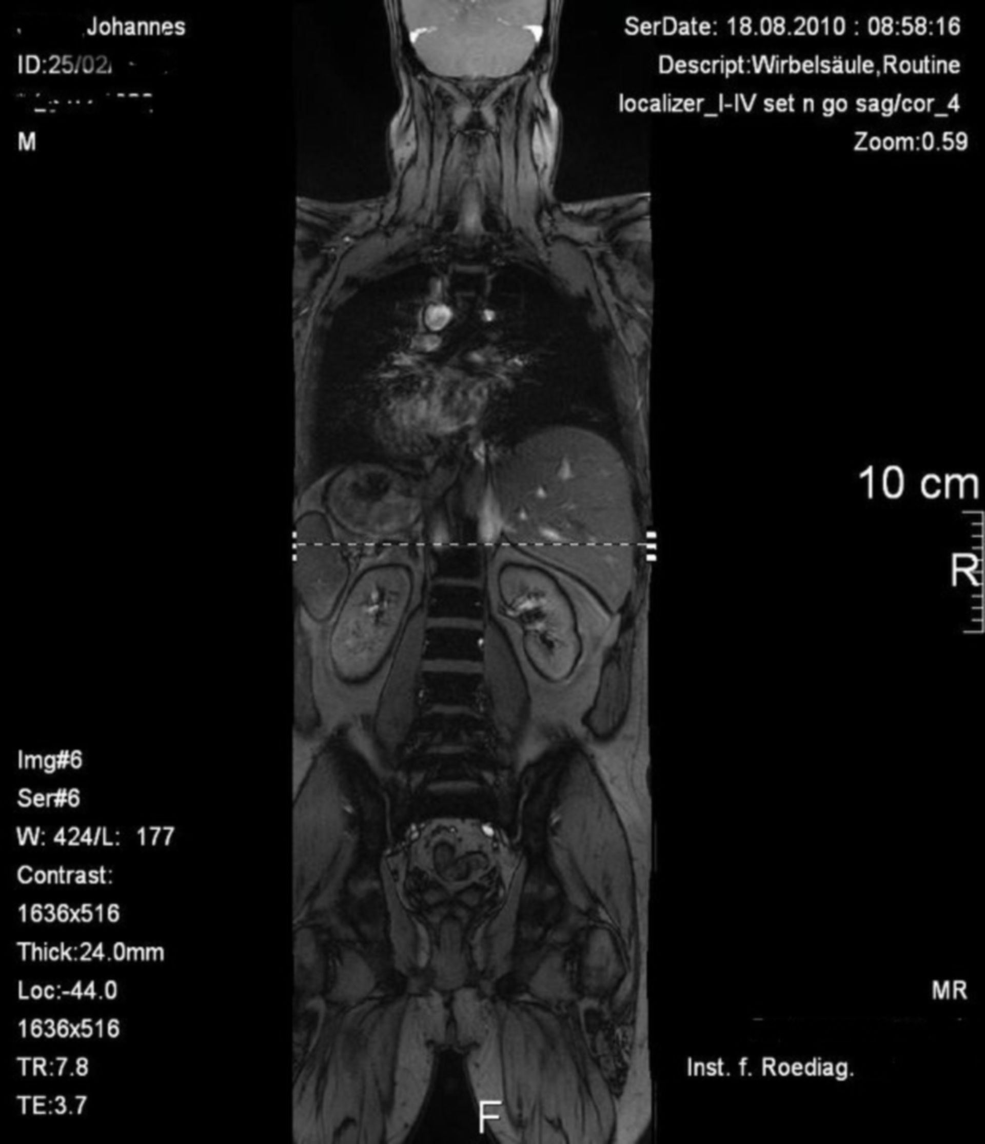 MRI Overview Image