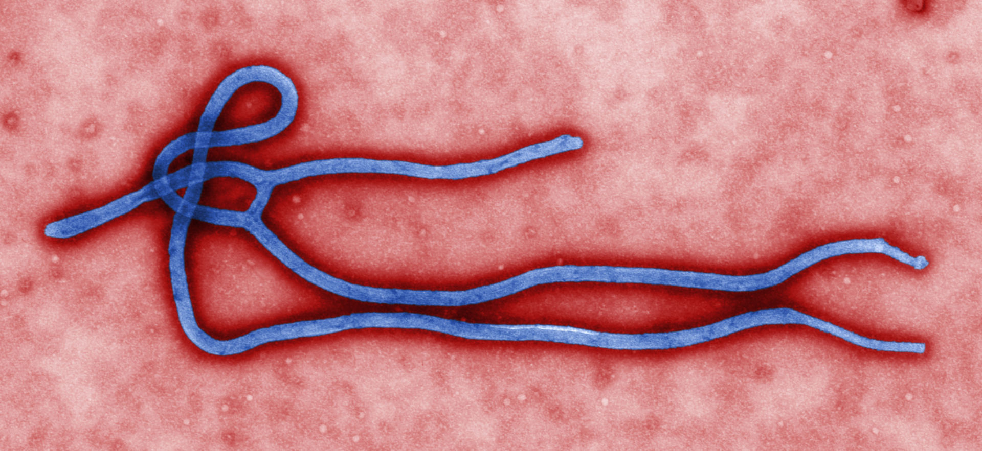 Ebola Virus (TEM, colored)