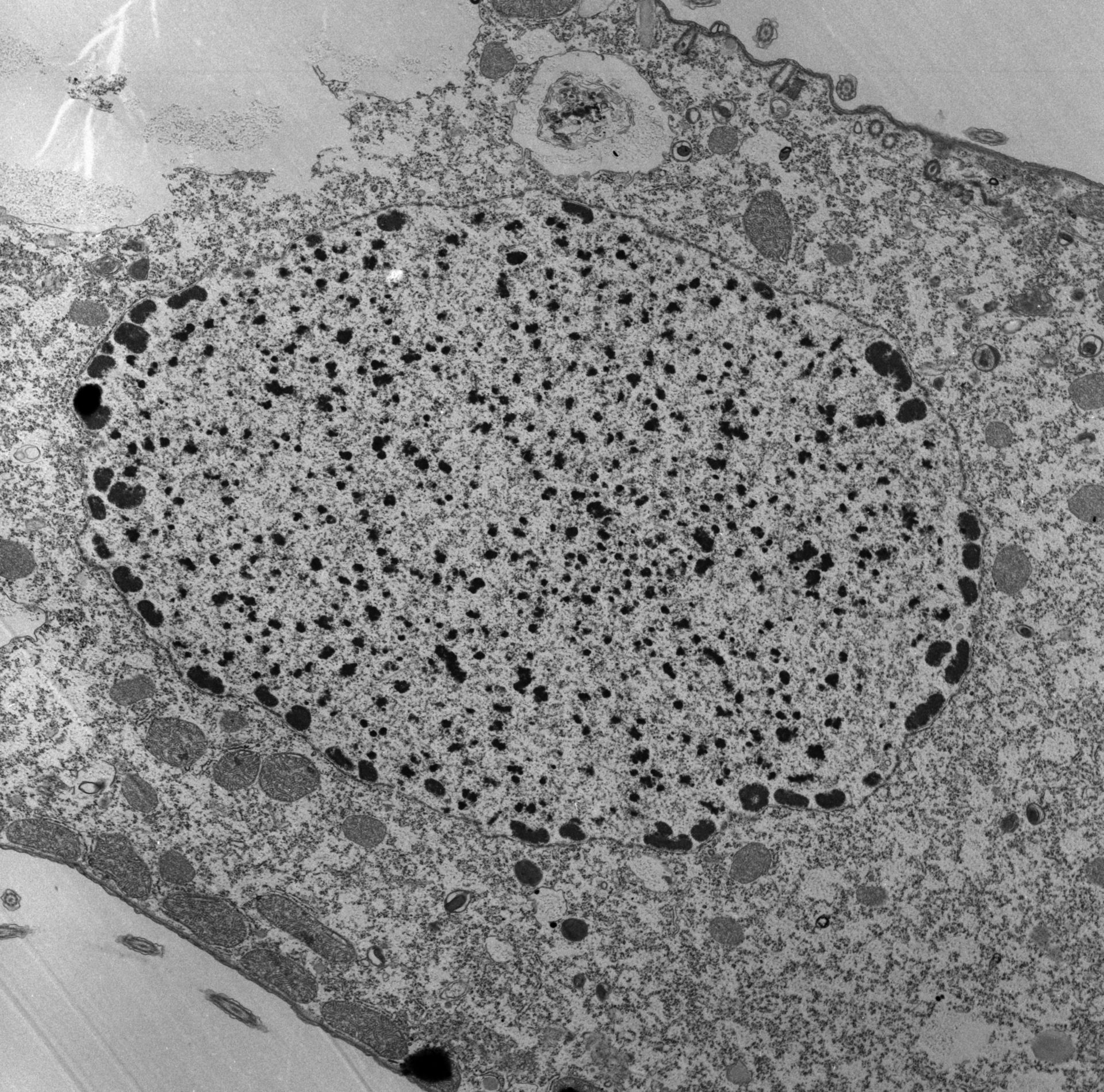 Tetrahymena pyriformis (Nucleolus) - CIL:39208