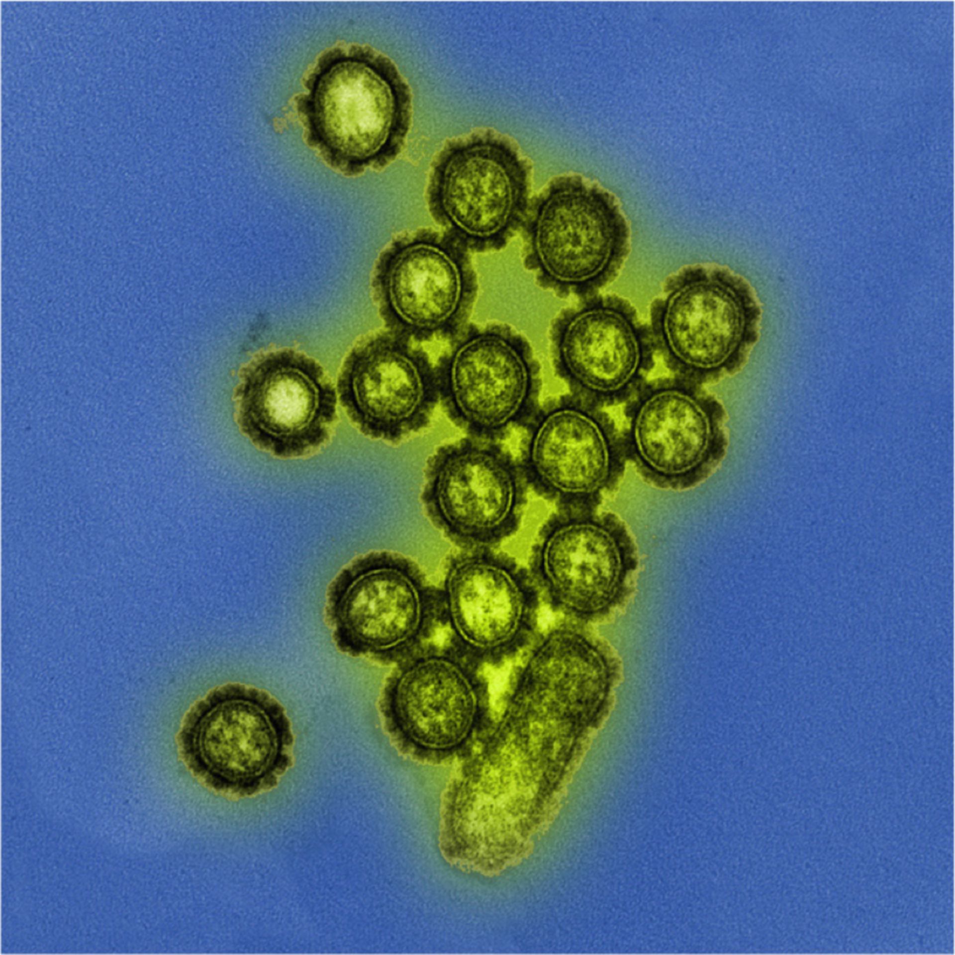 H1N1 Influenza Virenpartikel