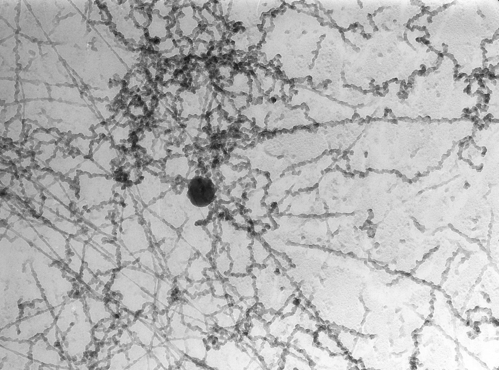 Notopthalmus viridescence (Nuclear chromatin) - CIL:10090