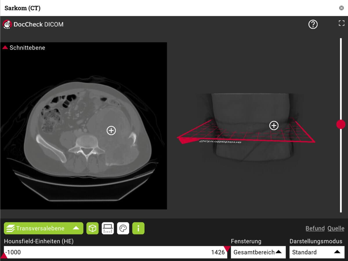 DICOM-Viewer 1
