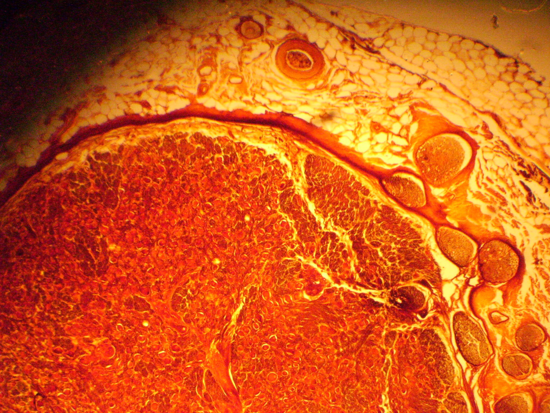 Multipolar ganglion cell