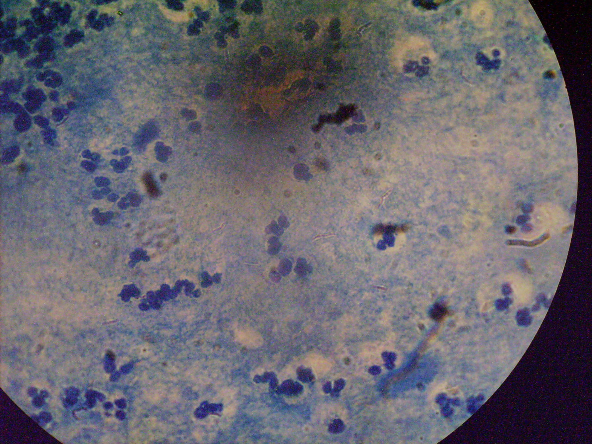 Mycobacterium tuberculosis MTB