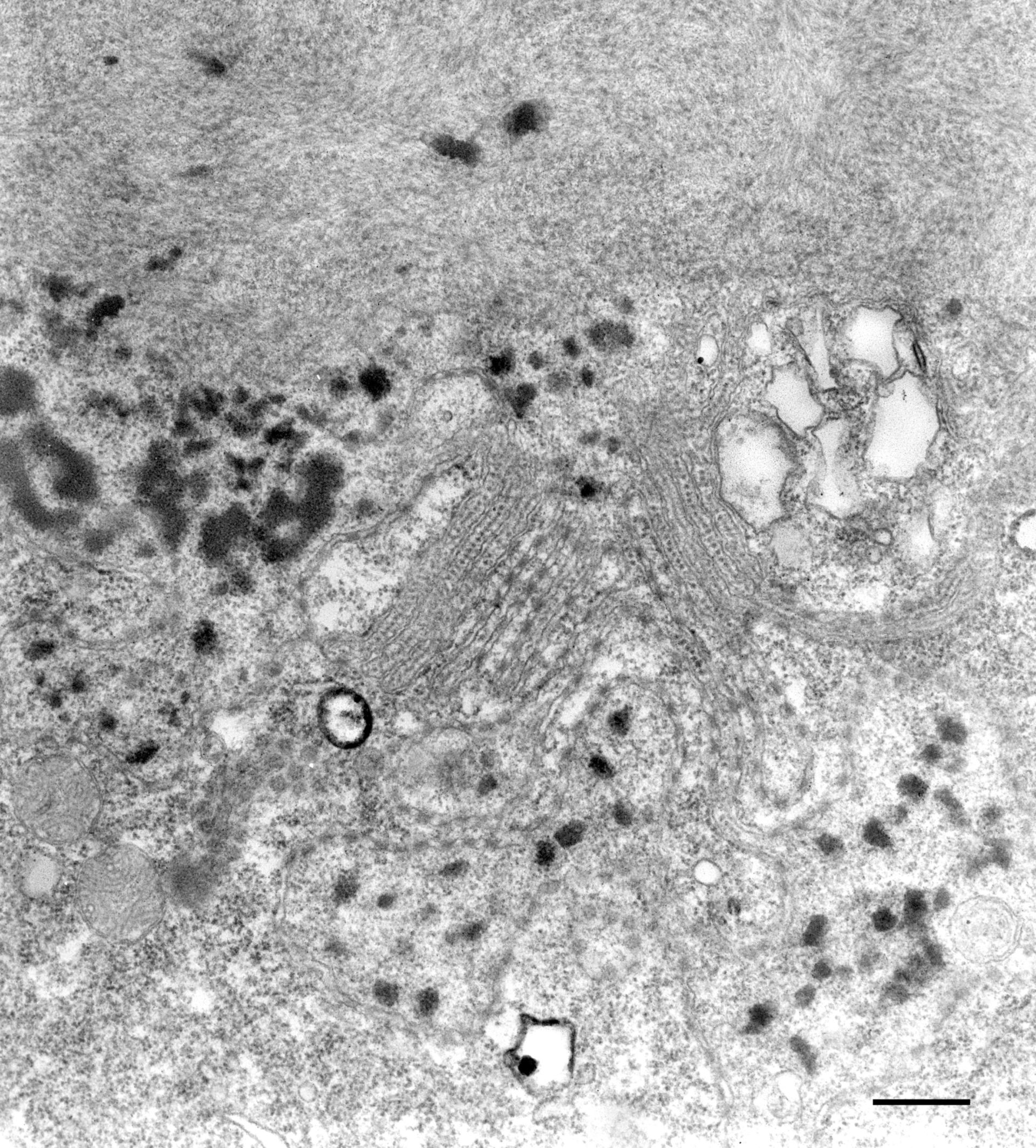 Paramecium multimicronucleatum (Nuclear pore) - CIL:36663