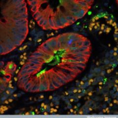 Atonie DocCheck Flexikon