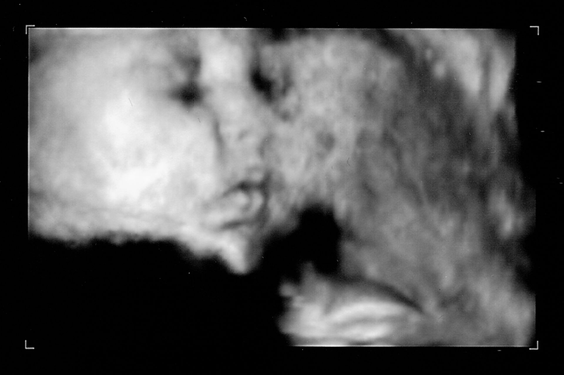 3D-ultrasound, 30 weeks pregnant