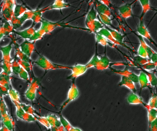 Verlust des DJ1 Gen in Nervenzellen (grün) beeinträchtigt den Transport von Mitochondrien (rot). © Universität Luxemburg