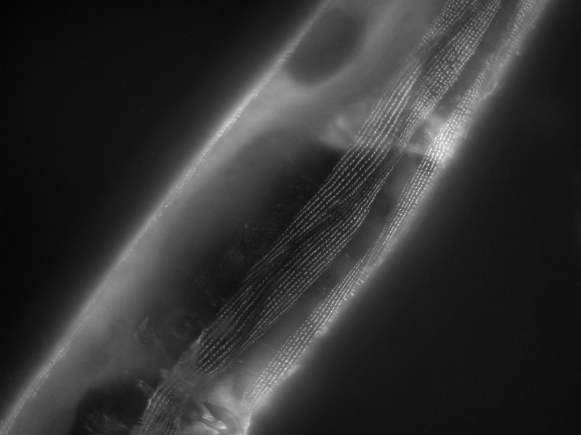 Caenorhabditis elegans (Actin filament) - CIL:1171