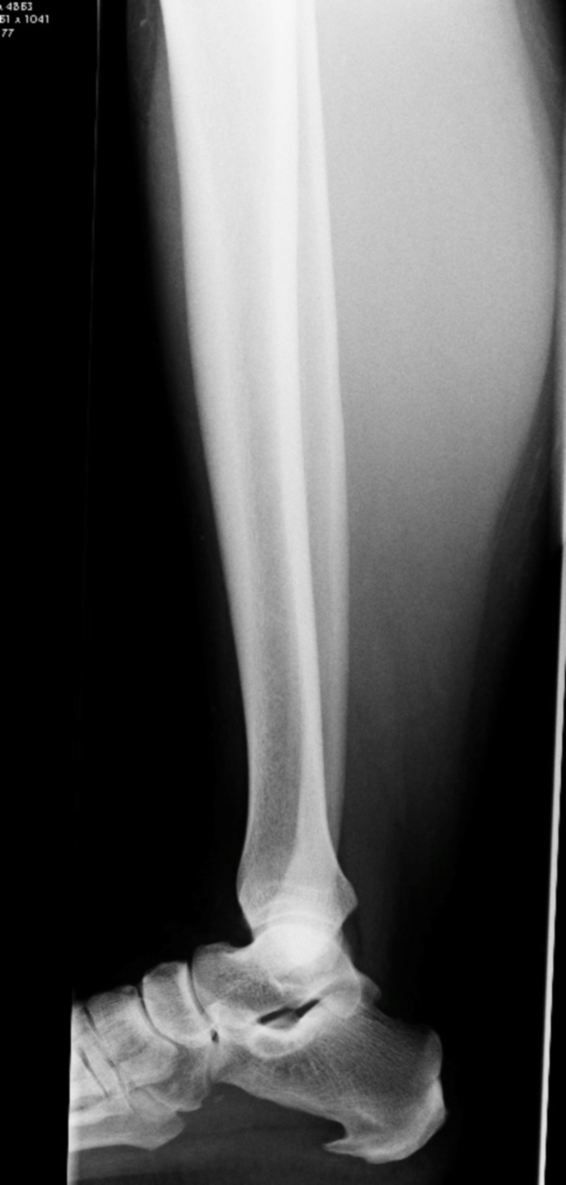 Röntgenbild Muskelstauchung nach Schlag aufs Bein