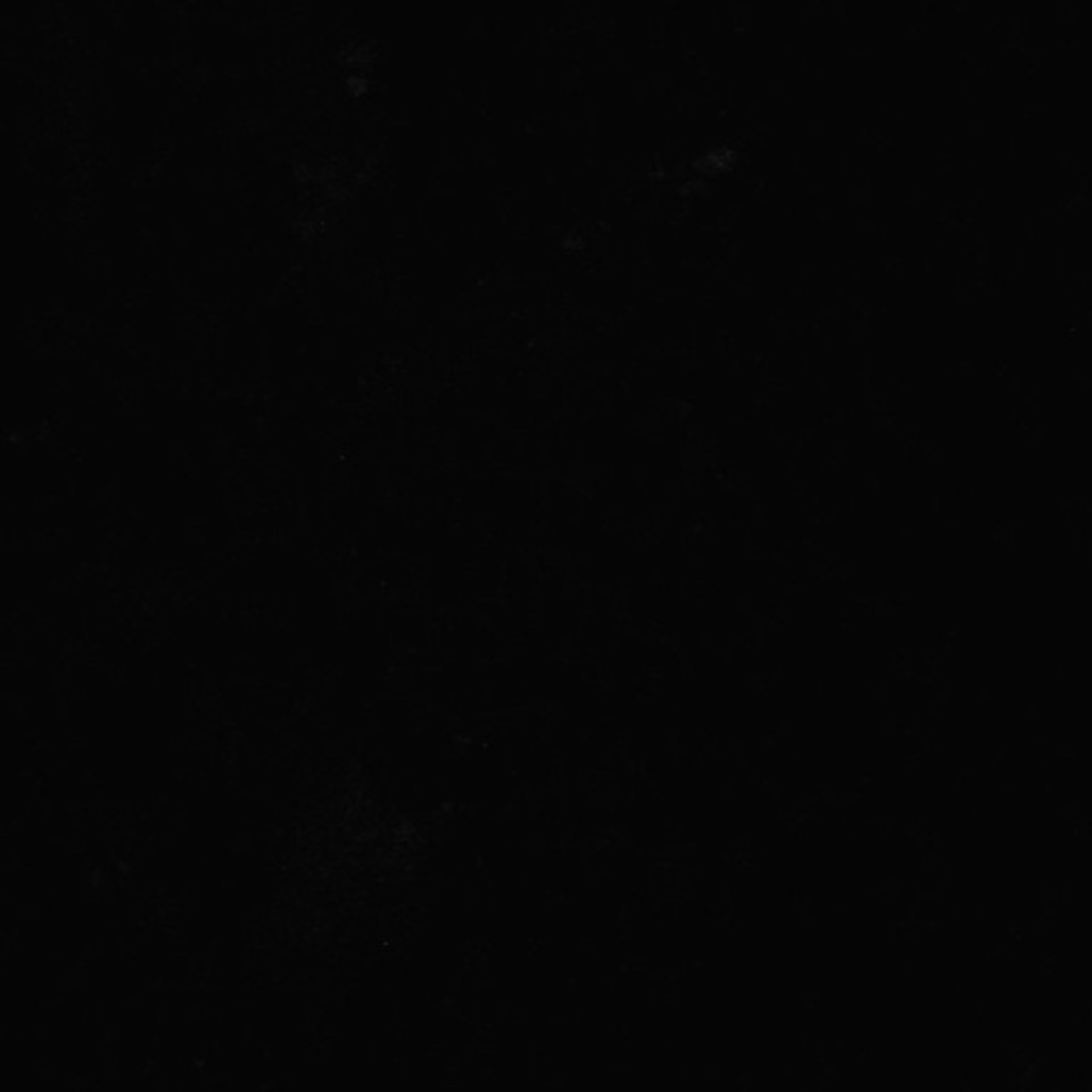 Xenopus laevis (Axon) - CIL:36976